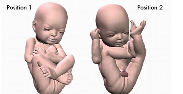 3D打印帶你見未出生胎兒！體位表情皮膚性別皆可見