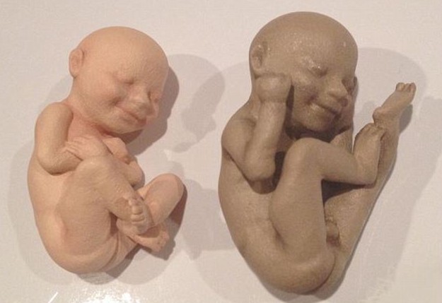 3D打印帶你見未出生胎兒！體位表情皮膚性別皆可見