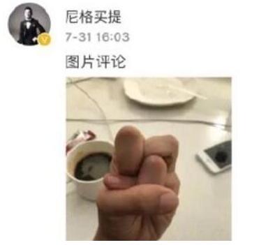 一般人做不出的張一山秋水誓？醫(yī)生：這是?。? style=