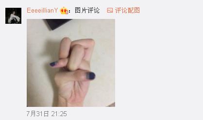 一般人做不出的張一山秋水誓？醫(yī)生：這是病！