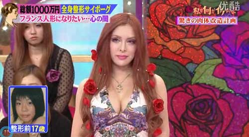 日本女?；?0萬美元整容30多次 欲成法式美女