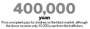 Kidney trafficking operation smashed