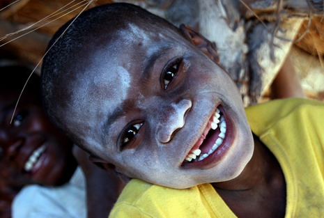 World Refugee Day