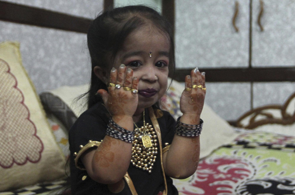 World's shortest living woman