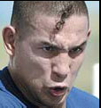 'Macho' Camacho brain dead