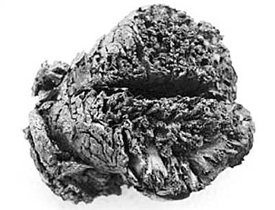 最古老的人腦緣何4000年不朽？