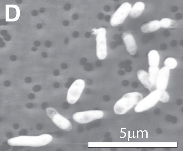 Arsenic-munching germ redefines 'life as we know it'