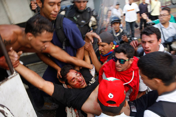 At least 2 killed by gunfire at Venezuela protests